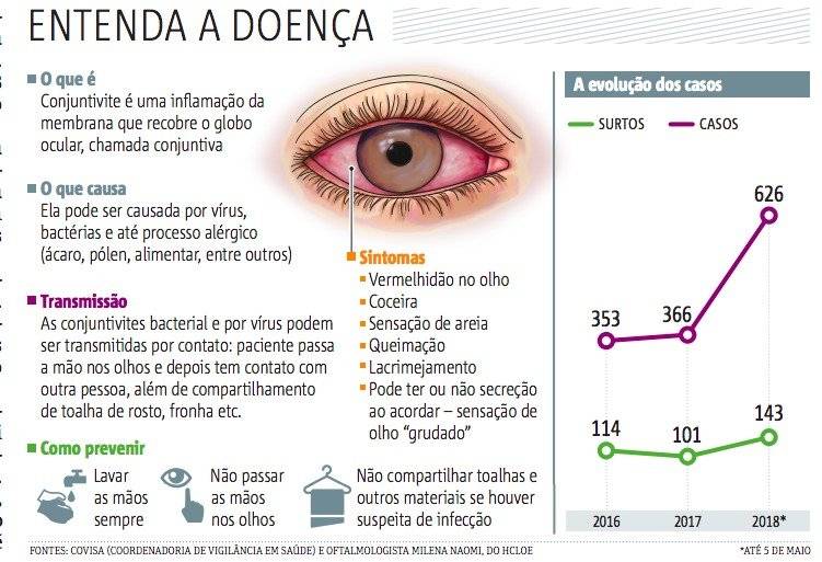 arte conjuntivite