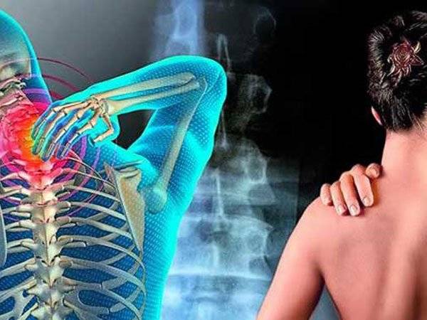 Fibromialgia Enfermedad Mujeres