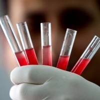 Coronavirus: estudio predice gravedad de síntomas de cada persona con la sangre