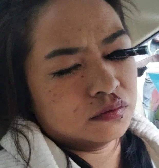Imagen de la tailandesa después del accidente
