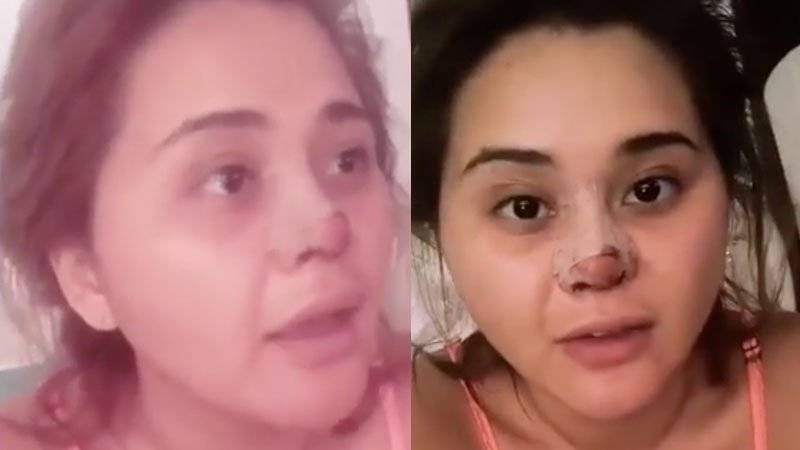 Nueva operación Gomita