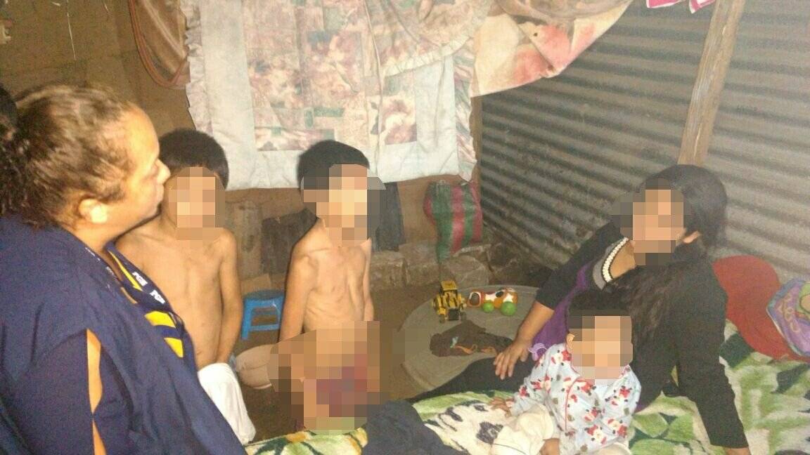 Niños maltratados y desnutridos