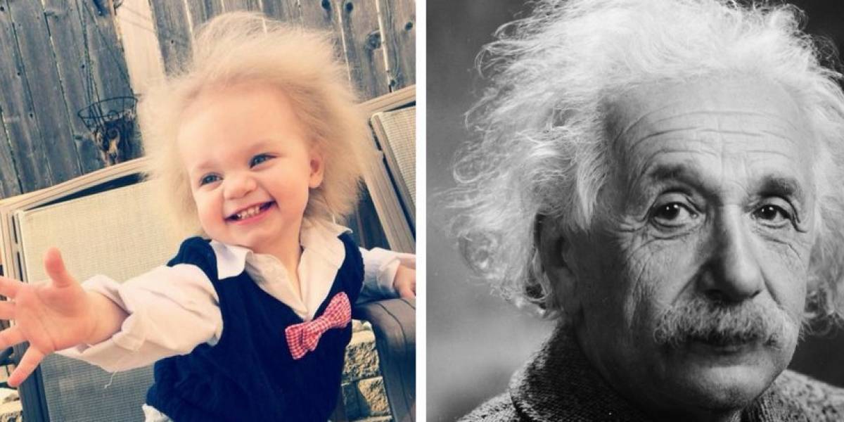"Baby Einstein 2.0", la pequeña que tiene una rara condición genética que hace imposible peinar su cabello