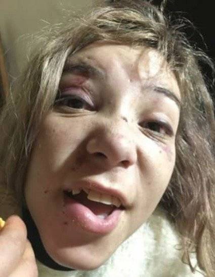 Imagen de una agresión anterior