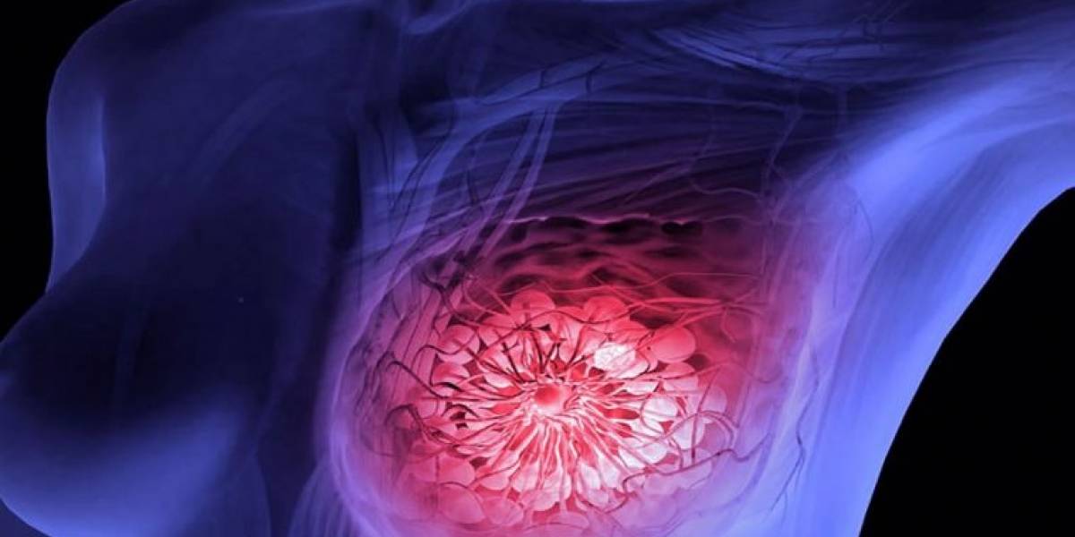 Descubren mecanismo clave para prevenir el temido cáncer de mama