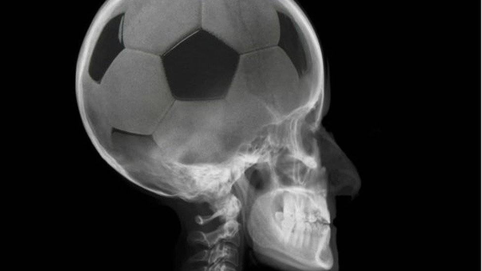 102169612copa5-358b2f9a088a3b56b43536906d540522.jpg
