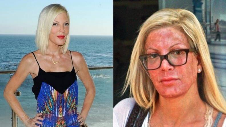 Tori Spelling rostro