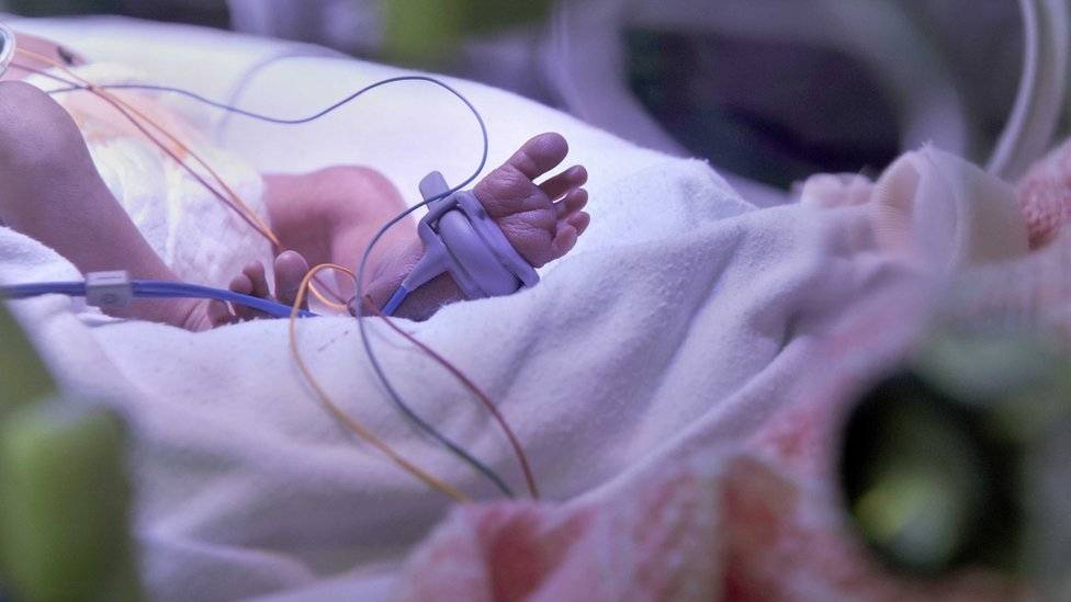 102311013neonatal-ecb92e19b5769232782fd2ab64755a00.jpg