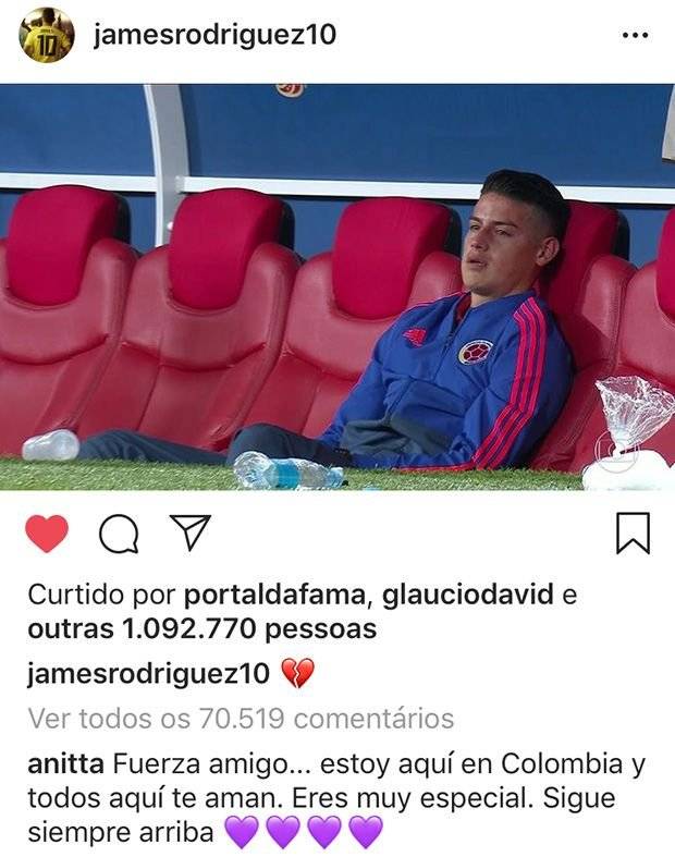 anitta james rodriguez instagram