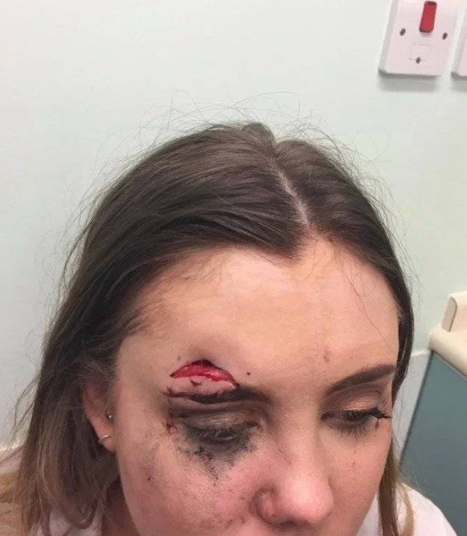 La joven pasó toda la noche en el recinto médico