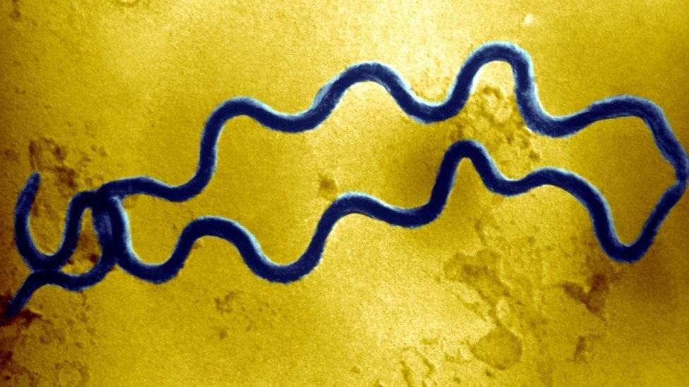 102519949sifibacteria-37b146bcfdeb179a57521fd1881f5fd7.jpg