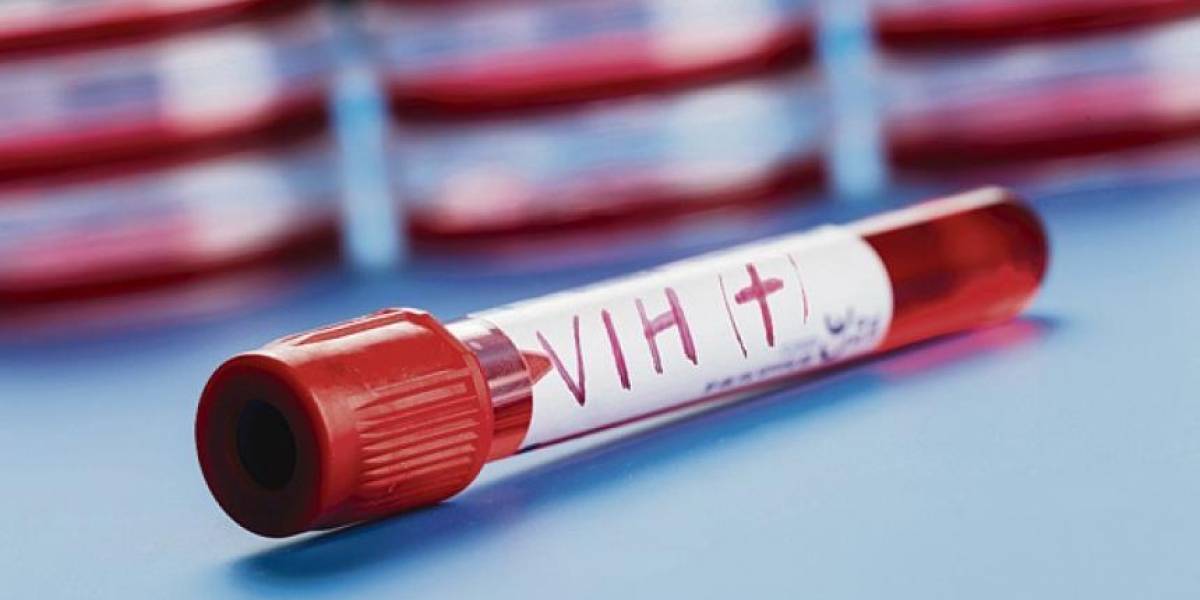 Estudio científico comprueba que ciertos medicamentos detienen la transmisión de la enfermedad del Sida