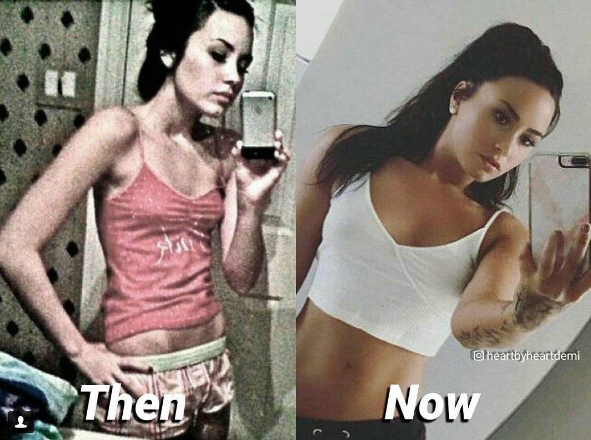 Demi Lovato