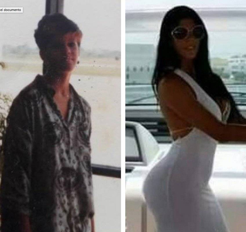 la foto del antes y después de