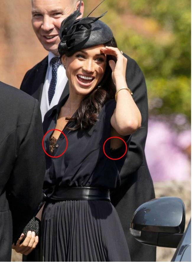 Meghan accidente ropa interior