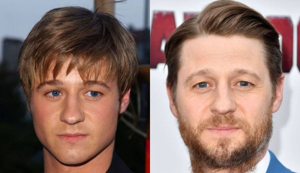 Ben McKenzie