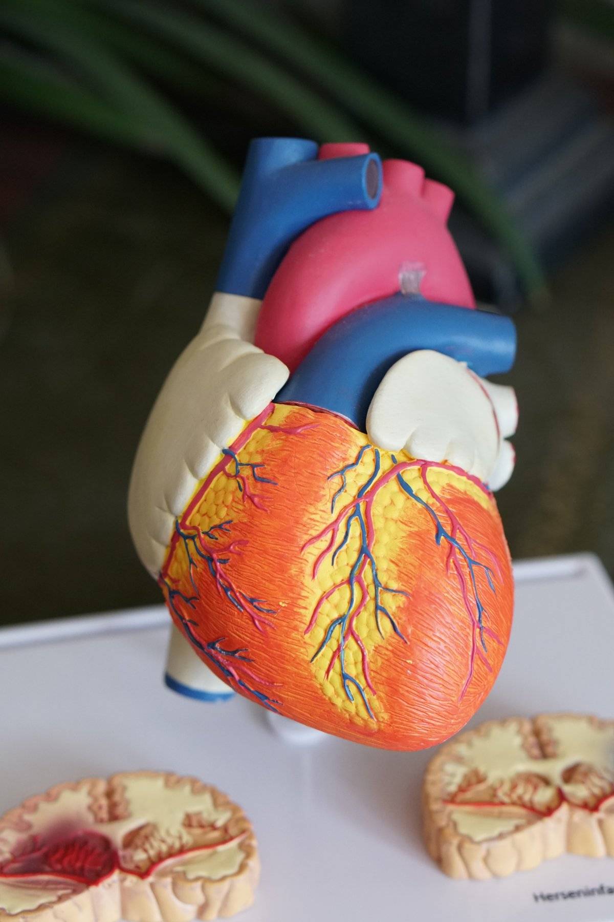 infarto