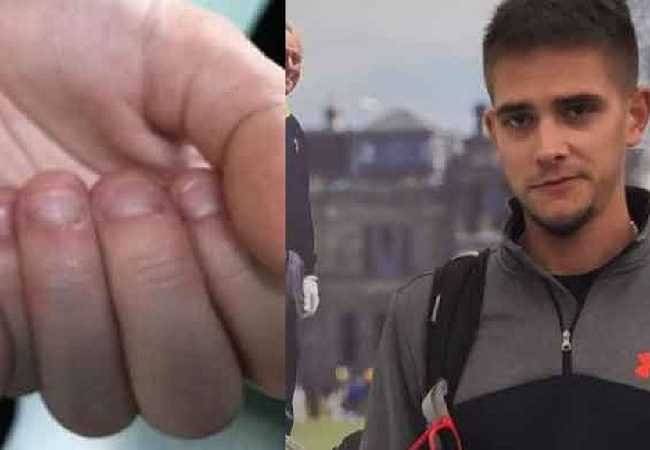 el habito letal de comerse las uñas