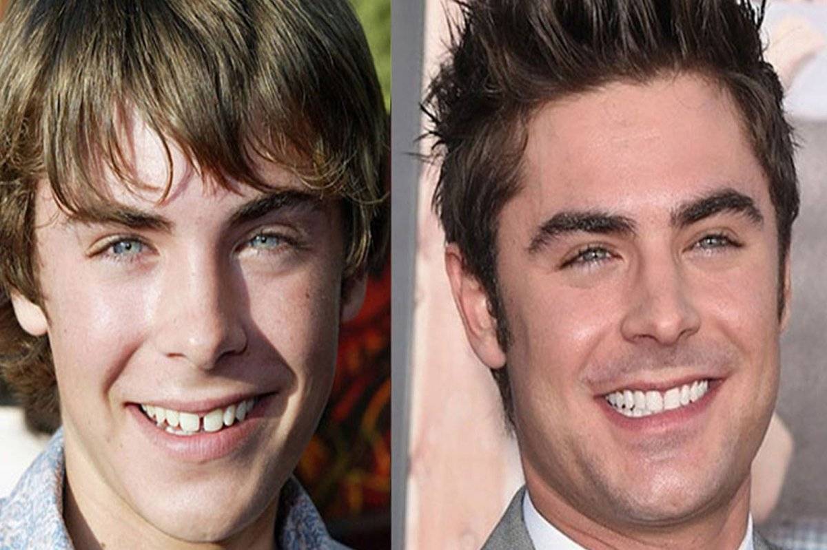Zac Efron