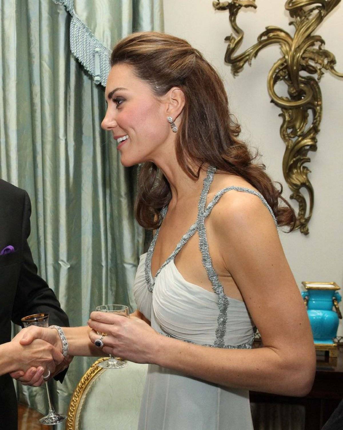 Kate Middleton cicatriz