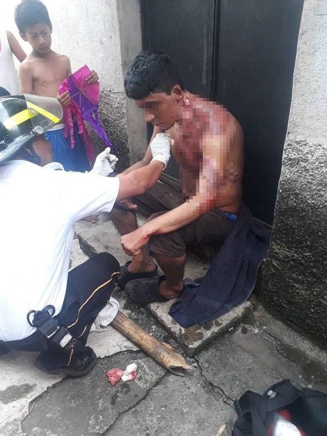 Herido