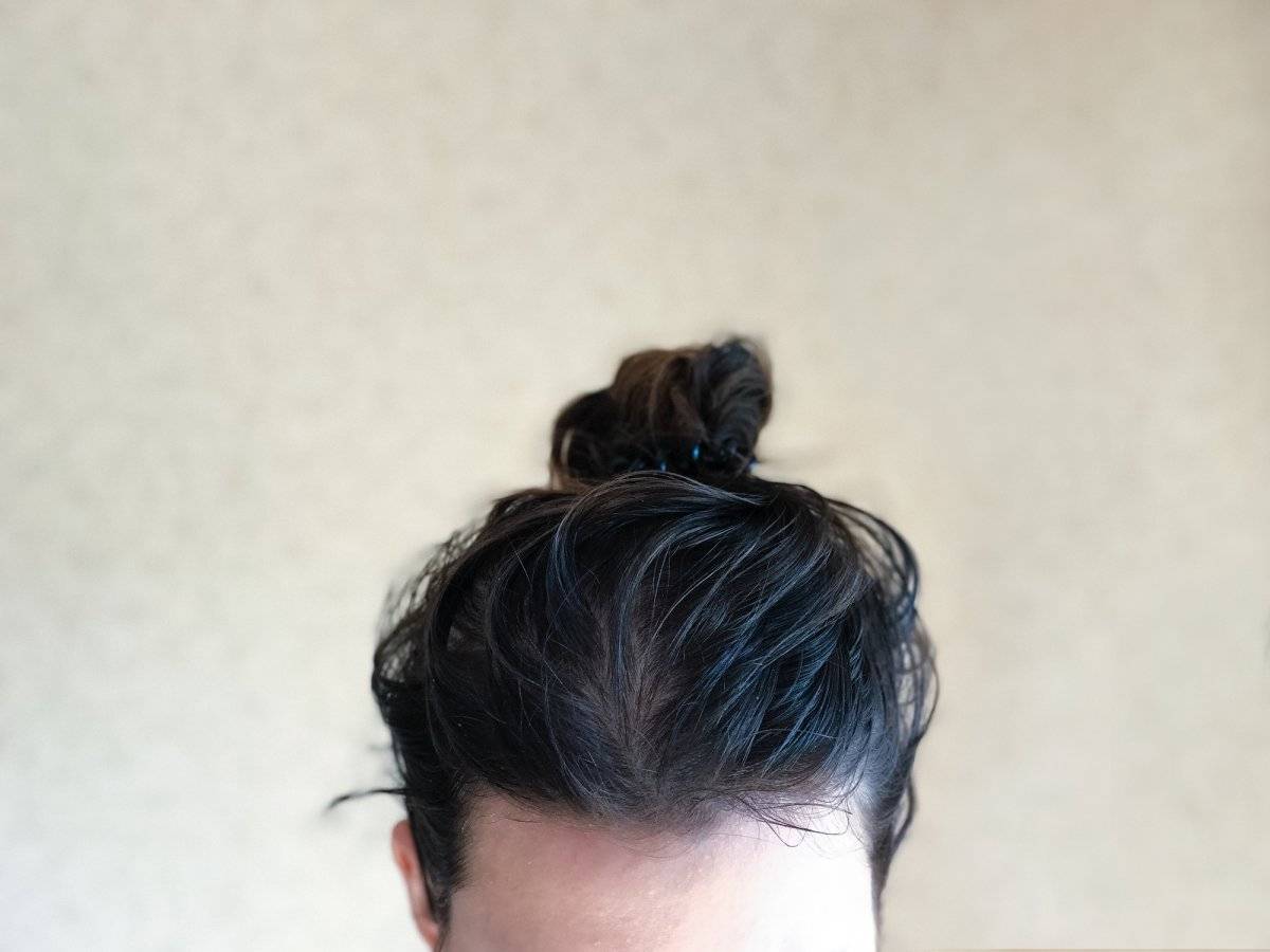 cabello graso