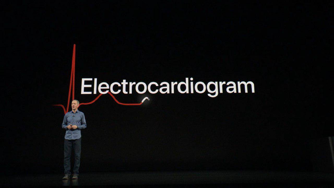 apple watch ecg