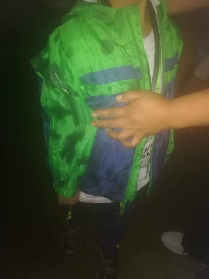 Lanzan aceite quemado a niños