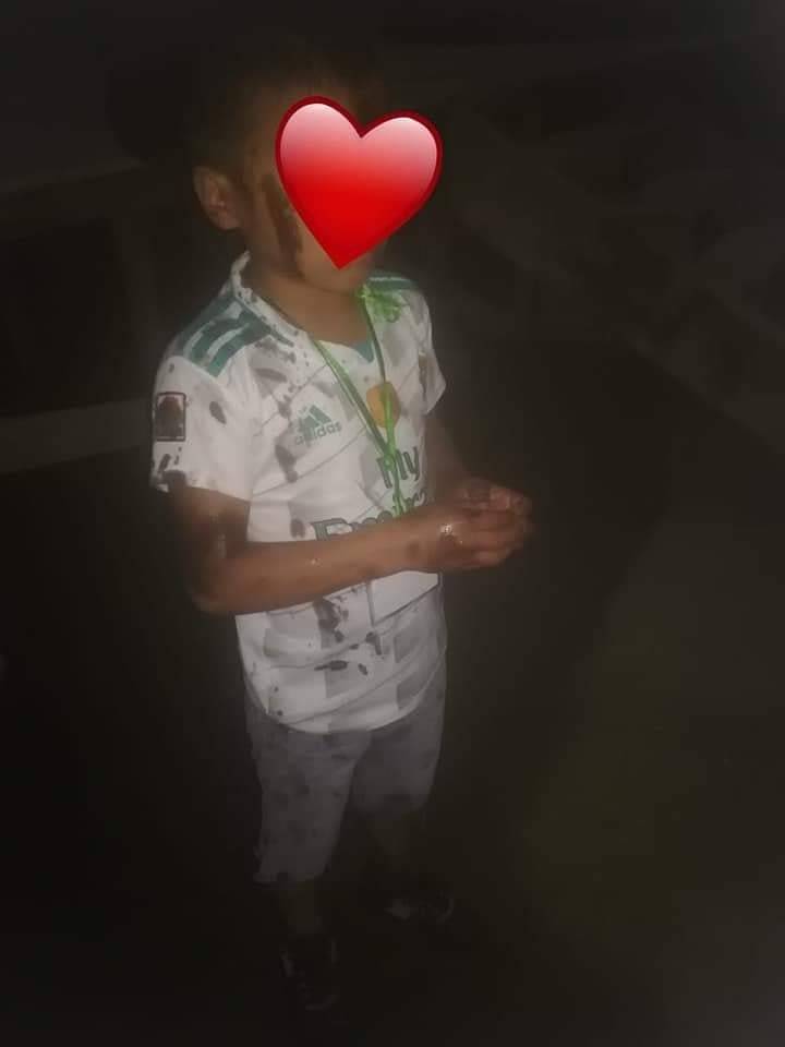 Lanzan aceite quemado a niños