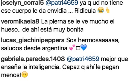 Critican las piernas de Sofía Caiche Critican las piernas de Sofía Caiche