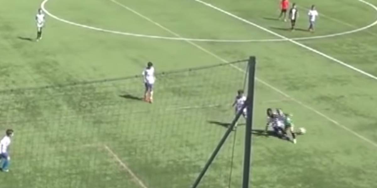 VIDEO La terrible fractura de tibia y peroné de un futbolista de nueve años