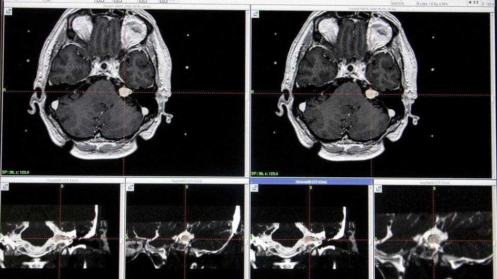 103799022lesion-76bf661839cc636a2f0c8a4a2bc9907b.jpg