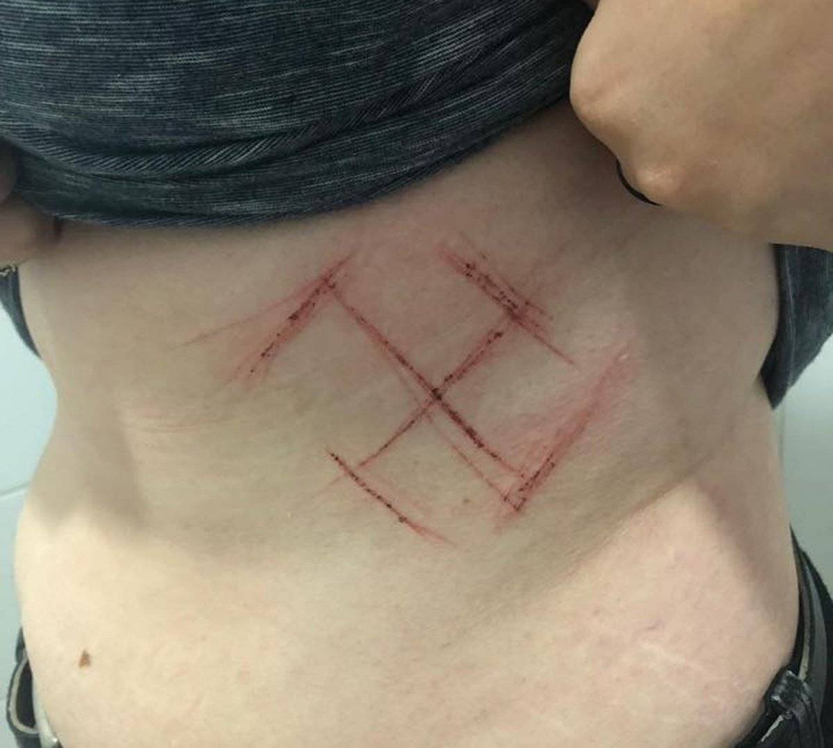 suástica na barriga