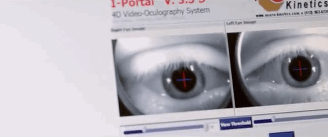 ojosexamen-fedabb3e06bac1985a81d369ff18ab4d.gif ojosexamen-fedabb3e06bac1985a81d369ff18ab4d.gif