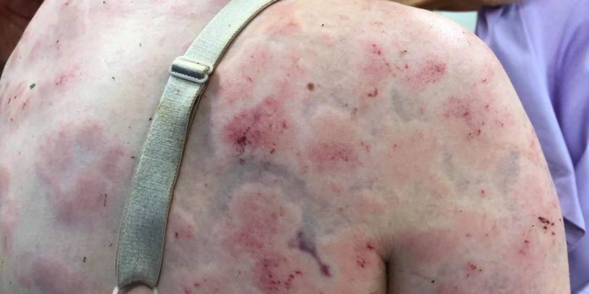 Mujer sufre graves lesiones tras proteger a su bebé de tormenta (Fotos)