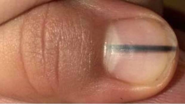 1343salud620x350-2c63edc2fa54492d51f8302af0a87ec8.jpg