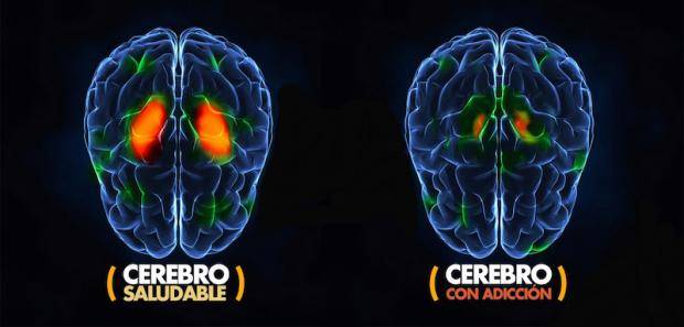20170207200224cerebro1620x6200-2a70e592241a2428271e3a28cb42f671.jpg 20170207200224cerebro1620x6200-2a70e592241a2428271e3a28cb42f671.jpg