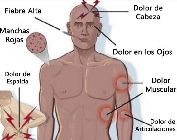 denguesintomas11-51c768a8f9feadabc5a024b63bf2a92b.jpg denguesintomas11-51c768a8f9feadabc5a024b63bf2a92b.jpg