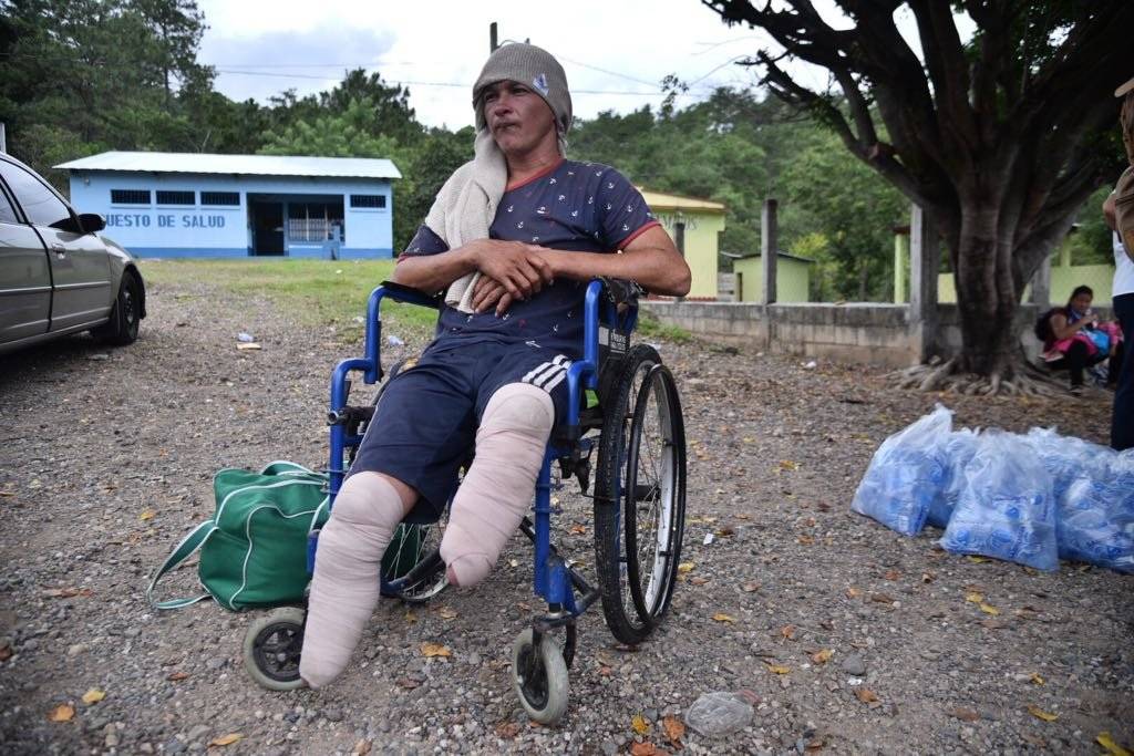 Nery Maldonado perdió sus pies
