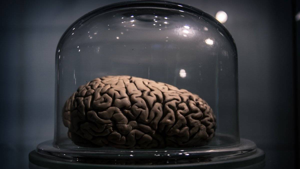 researchersdiscoverthatthebrainforgetsinordxhvd-2c673fcf3c9d981856ac03857d6ccb5b.jpg researchersdiscoverthatthebrainforgetsinordxhvd-2c673fcf3c9d981856ac03857d6ccb5b.jpg