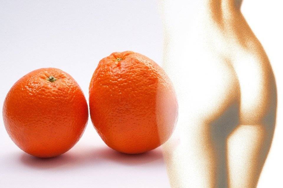 Celulitis