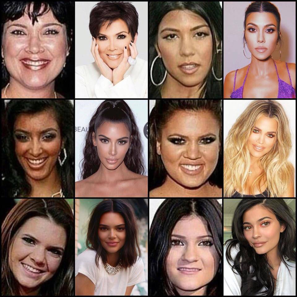 Kardashians, antes e depois