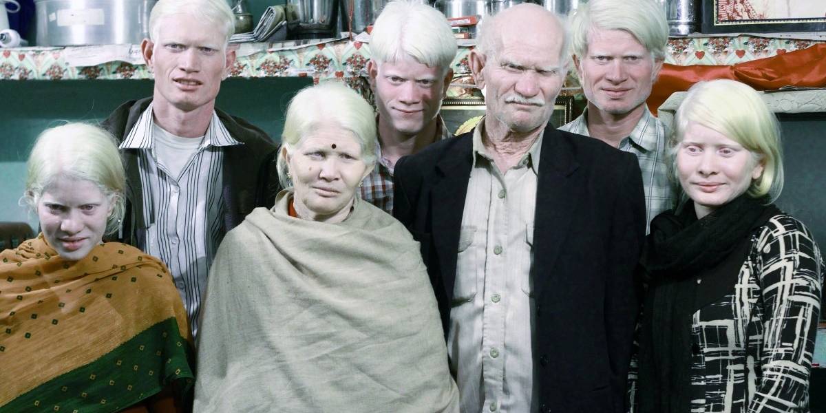 Histórico: Realizan el primer censo digital de albinos en Chile