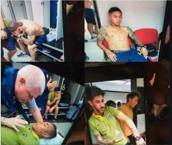 Los jugadores afectados tras la agresión de bus a Boca Juniors