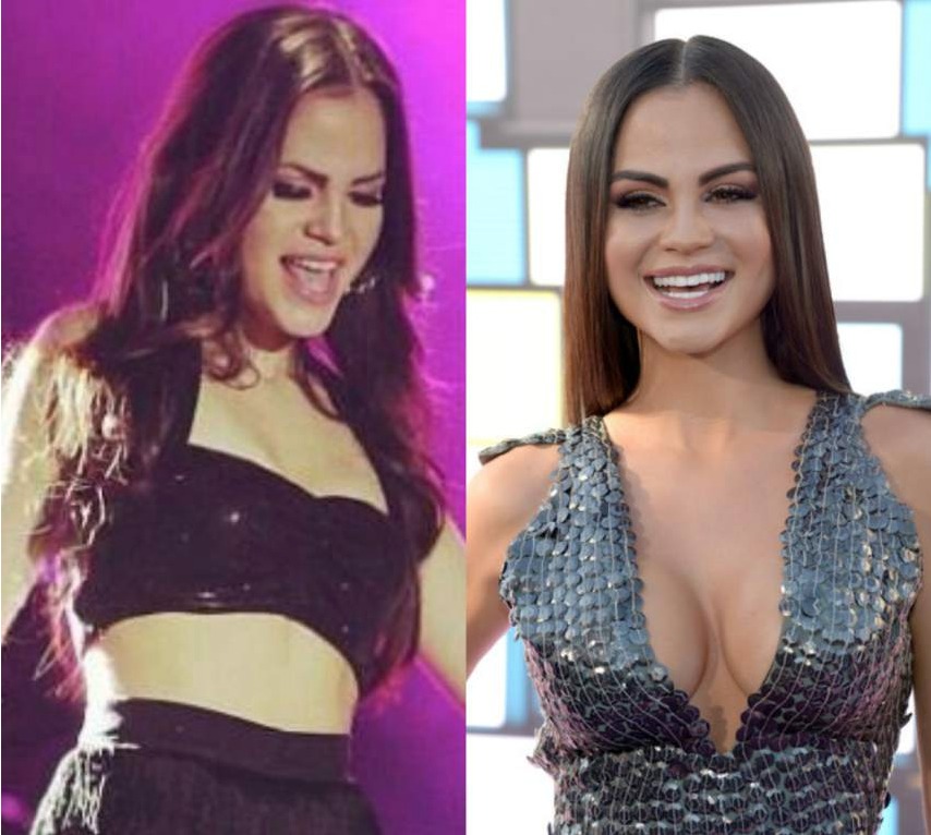 Las cirugías de Natti Natasha se aumentó el busto Las cirugías de Natti Natasha se aumentó el busto