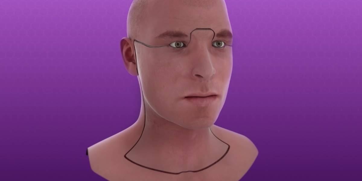 No podrás creer los increíbles resultados de este transplante de rostro