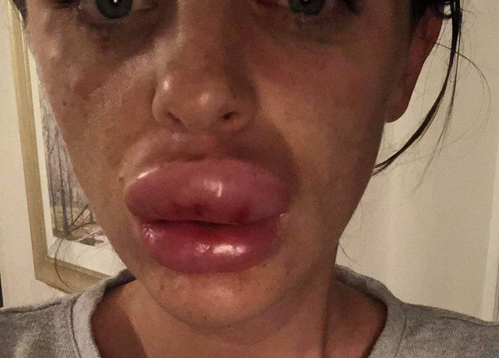 104618205lips2-c938d2984164b1c25ca378e7be8c1ca3.jpg