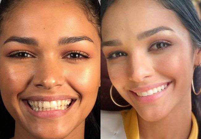 Kiara Liz Ortega Antes y Después