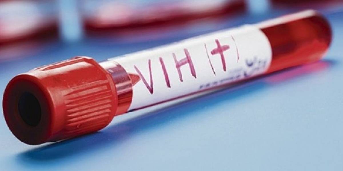 Lubricante anti VIH entra a fase de pruebas