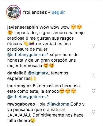 Reacciones en redes tras fotos de Miss Venezuela antes de las cirugías